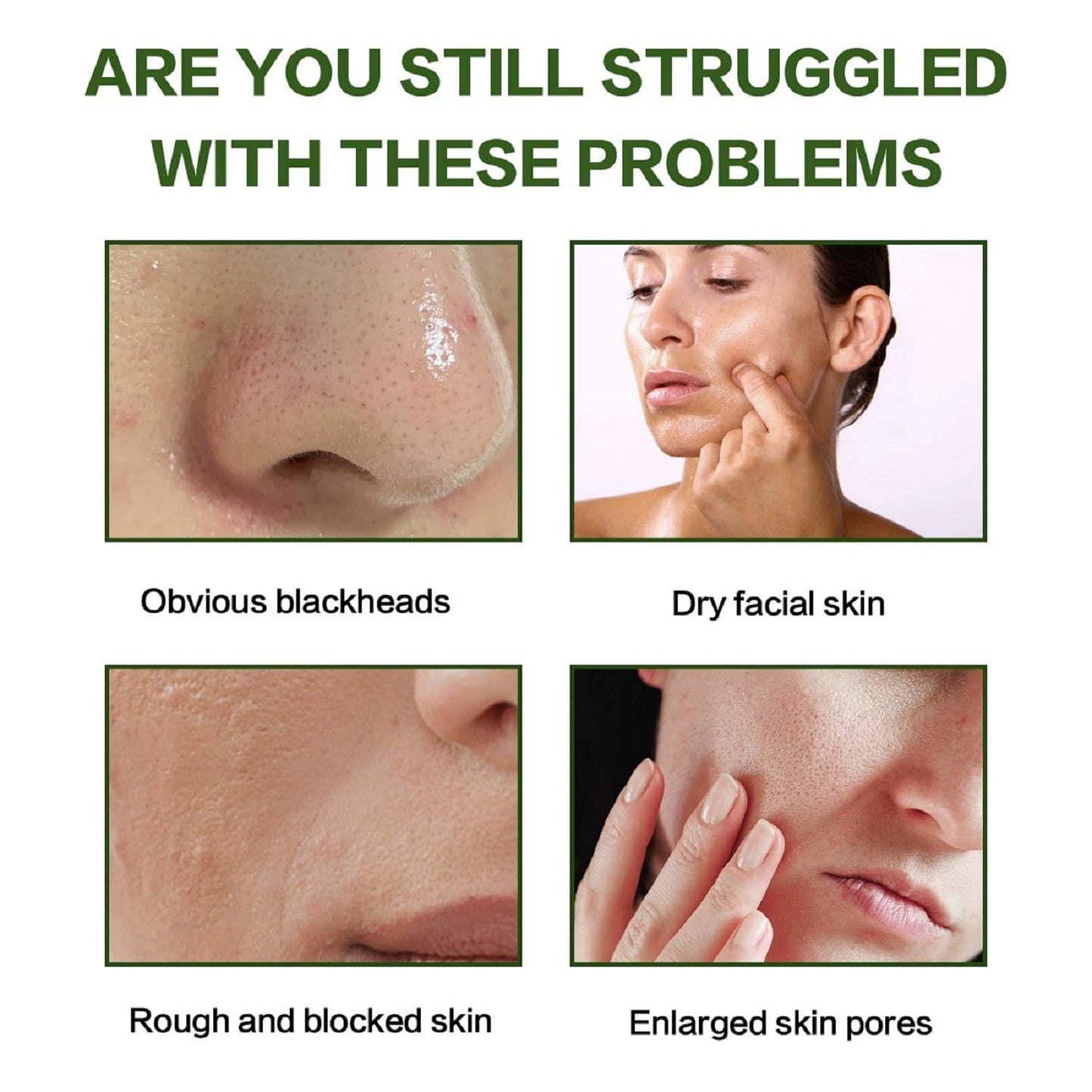 Recovery Mud Mask, Relief Mud Mask for Face & Body, Hydrating & Deep Pore Cleanser, Nature-Derived Ingredients, Oil Control Wash Off Body Mud