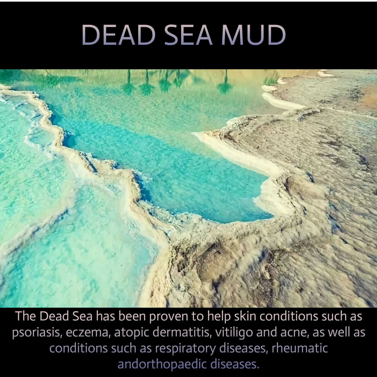 Dead Sea Mud Mask for Face and Body - Spa Quality Pore Minimizer for Acne, Beauty Face and Skin, Natural Skincare for Women, Men - Tightens Skin, Facial Skin Care Face Mask - 8.8 oz