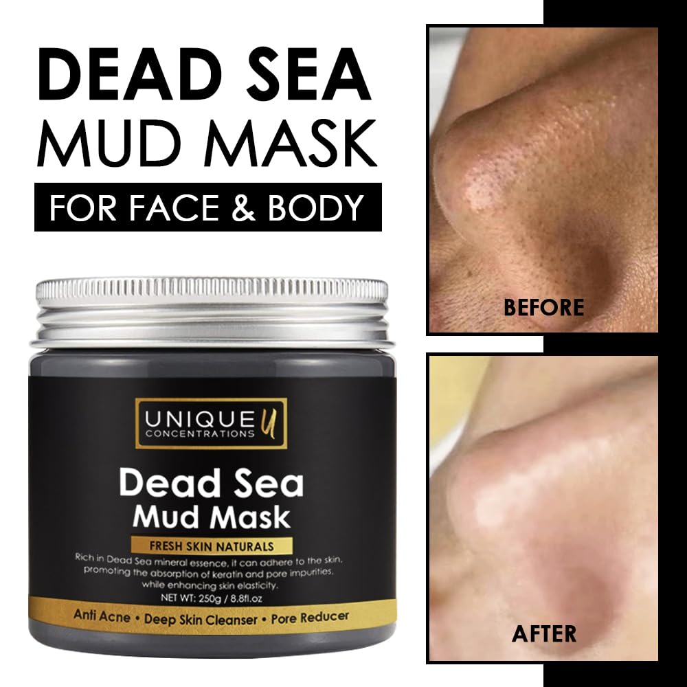 Dead Sea Mud Mask for Face and Body - Deep Cleansing, Exfoliating, Detoxifying for Acne, Blackheads, Oily Skin, and Pore Clearing - 100% Natural Mineral-Rich Formula for Men and Women - 8.8 oz